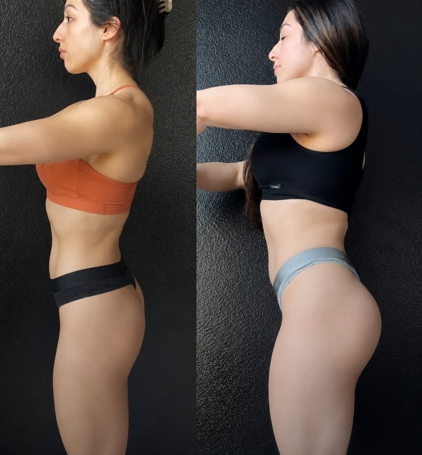 Client transformation